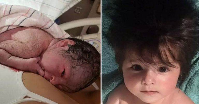 Semua Orang di Ruang Bersalin Terkejut Ketika Mereka Melihat Tubuh Bayi Itu