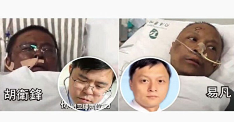 Wajah Dua Dokter yang Terinfeksi Virus Corona Menjadi Hitam, Kemungkinan Virus Sebabkan Kerusakan Organ Hati