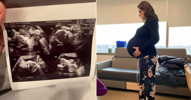 Kelahiran Bayi Kembar Empat yang Identik, Kasus yang Hanya Terjadi pada 1 dari 15 Juta Kelahiran