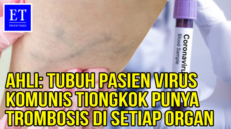 Ahli: Tubuh Pasien virus Komunis Tiongkok Punya Trombosis di Setiap Organ