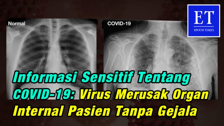 Informasi Sensitif Tentang COVID-19 : Virus Merusak Organ Internal Pasien Tanpa Gejala