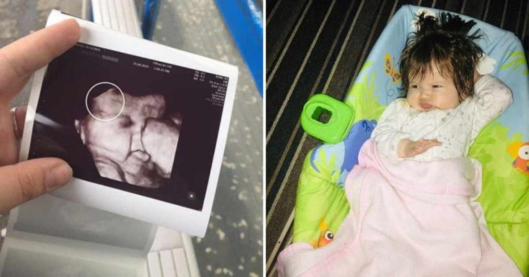 Penampilan Bayi Keduanya Mengejutkan Semua Orang di Ruang Bersalin