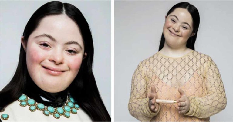Remaja dengan Sindrom Down Ini Mejadi Model untuk Gucci dan Vogue Italia