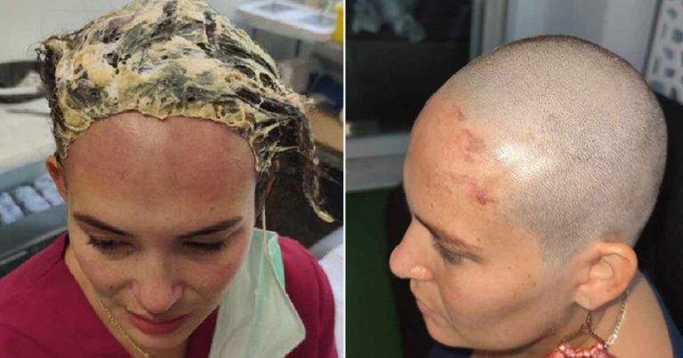 Wanita Ini Mencukur Gundul Rambutnya Setelah Orang Asing Meletakkan Topi yang Penuh Lem di Kepalanya