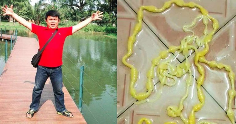Seorang Pria Dibuat Tertegun Setelah Menarik Cacing Pita Sepanjang Lebih dari 5 Meter Saat Buang Air Besar