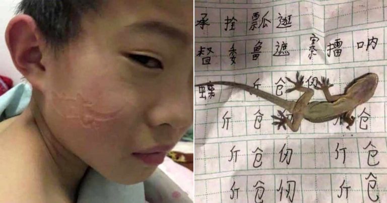 Bocah di Taiwan Memiliki Jejak Cicak di Wajahnya