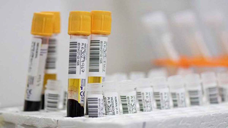 Penasihat CDC : Vaksin COVID-19 Johnson & Johnson Tidak ‘Dipilih’ Terkait dengan Kondisi yang Parah