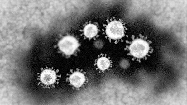 Varian Virus Mutan Mu Menyerang 26 Negara Hingga Netizen Zhangjiajie, Tiongkok Mengungkap ‘Kekacauan Vaksin’