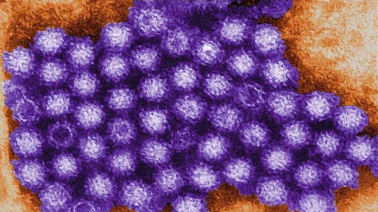 <strong>Wabah Norovirus Meningkat di Seluruh AS dan Kanada : Ini yang Perlu Anda Ketahui</strong>