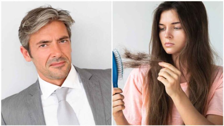Ketika Rambut Beruban Sebelum Waktunya, Ini 3 Hal yang Harus Dilakukan Selain Mewarnainya