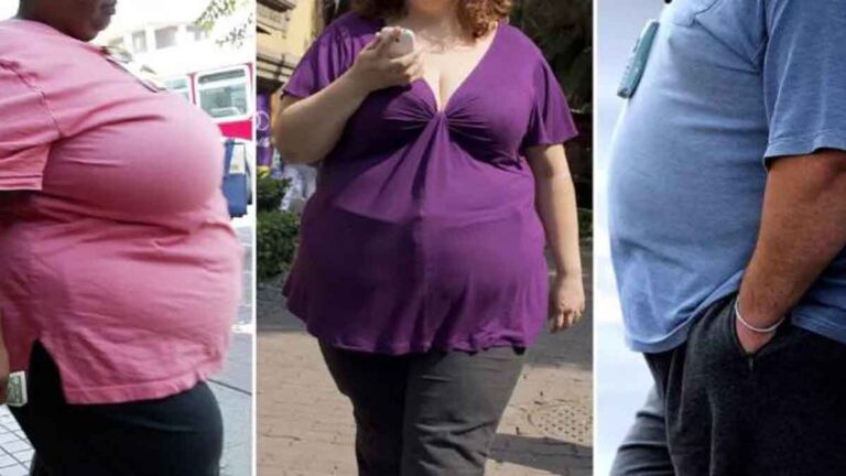 Wanita Rentan Mengalami ‘Makan Berlebihan Secara Emosional’: Studi Ungkap Perbedaan Obesitas Antar Gender
