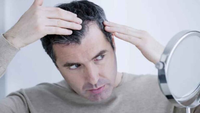 Menguak Rahasia Rambut Sehat: 5 Penyebab Rambut Rontok dan Beruban Dini serta Cara Mengatasinya