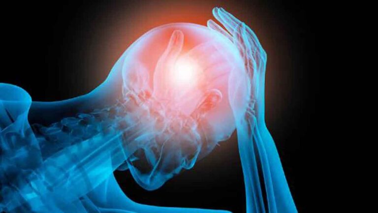 Metode Sederhana untuk Meredakan Sakit Kepala yang Membandel