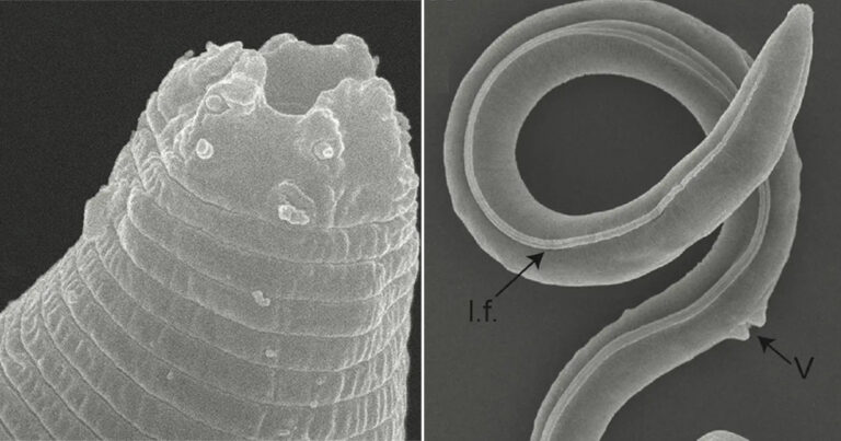 Parasit ‘Hidup’ Berusia 46.000 Tahun Ditemukan di Es, Seperti Dongeng ‘Sleeping Beauty’