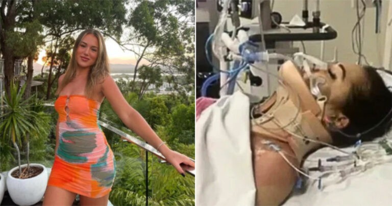 Wanita Melbourne Kejutkan Staf Medis dengan Ajaib Selamat Setelah Jatuh Fatal dari Lantai 7