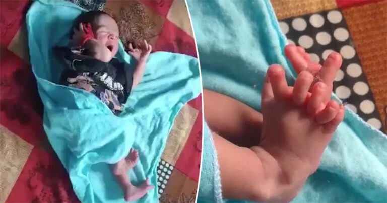Bayi yang Lahir dengan 26 Jari Tangan dan Kaki Disebut Sebagai ‘Reinkarnasi Dewi Hindu’