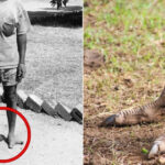 Misteri-Dibalik-Sindrom-Kaki-Burung-Unta-Suku-Vadoma