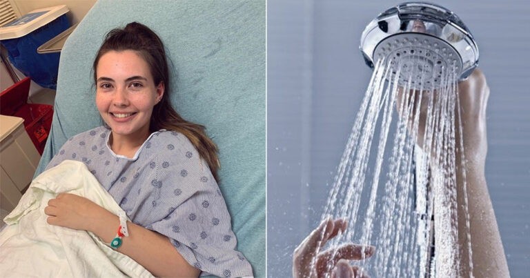 Wanita yang Alergi Terhadap Air Mengatakan ‘Kulit Kepalanya Akan Berdarah’ Setelah Mandi