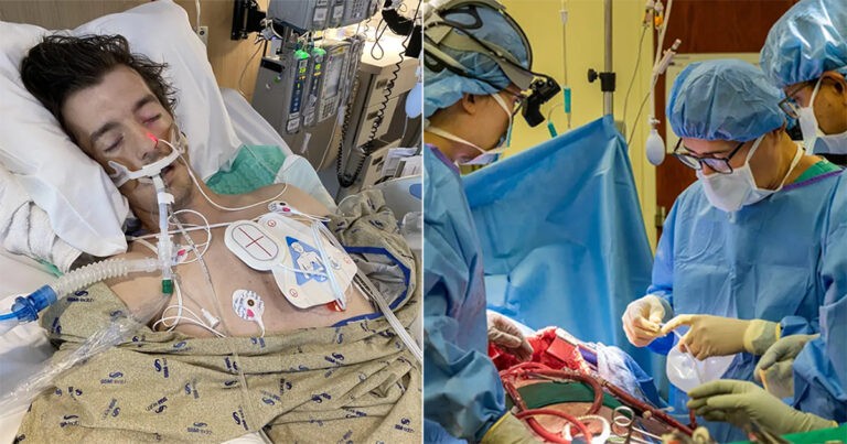 Dokter Menggunakan Implan Payudara untuk Menyelamatkan Pasien Transplantasi Paru-paru yang Hampir Meninggal Karena Vaping