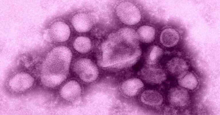 Kasus Flu Babi Varian Pertama pada Manusia Terdeteksi Saat Petugas Berjibaku Tracing Kontak Erat