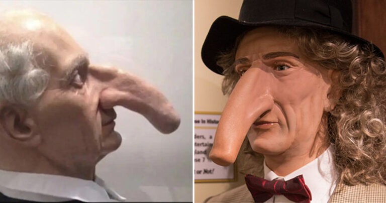 Pria dengan Hidung Terpanjang di Dunia Belum Bisa Memecahkan Rekornya