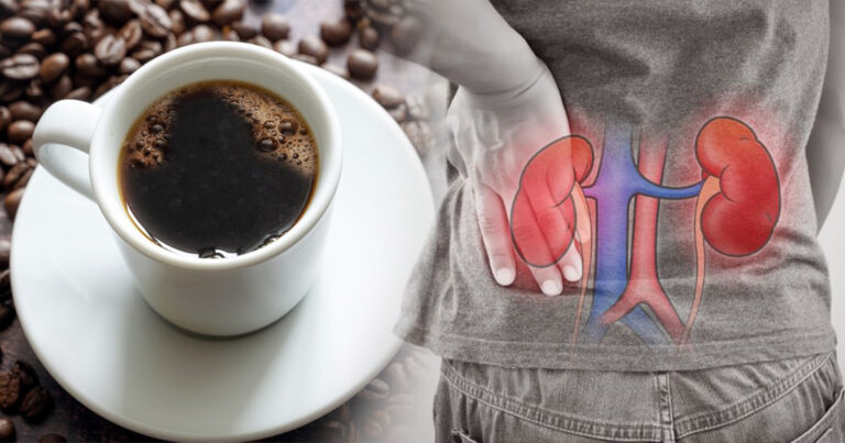 Menghilangkan Mitos Tentang Kafein Dan Kesehatan Ginjal Anda