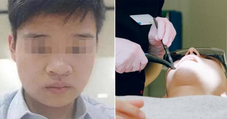 Pria Berusia 23 Tahun di Tiongkok Meninggal Secara Tragis Setelah Cabut Gigi