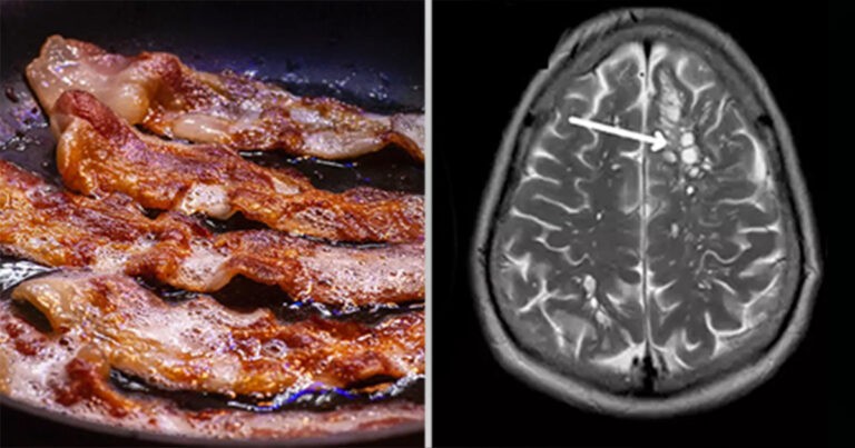 Alasan yang Sangat Berbahaya Mengapa Anda Tidak Boleh Makan Bacon Setengah Matang