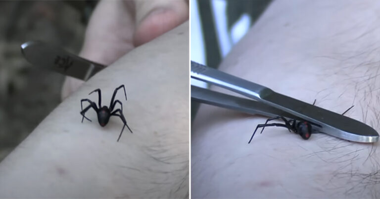 Pria Membiarkan Laba-laba Janda Hitam Menggigitnya untuk “Membongkar Mitos” dengan Hasil yang Mengejutkan