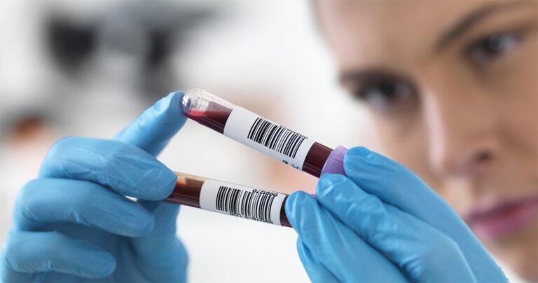 Tes Darah Dapat Mengungkap Usia Biologis Anda dan Memprediksi Risiko Penyakit