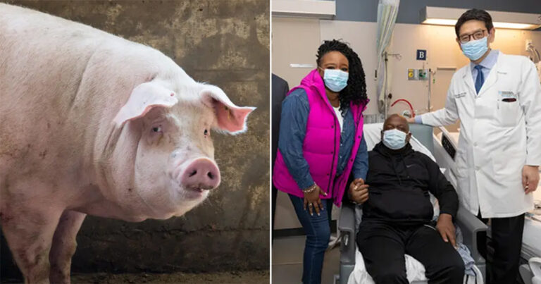 Seorang Pria Meninggalkan Rumah Sakit dengan Tagihan Rp 0 Setelah Menerima Ginjal Babi dalam Transplantasi yang Inovatif