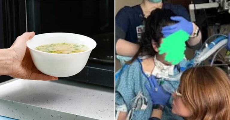 Wanita Menjadi Lumpuh Setelah Makan Sup Sisa