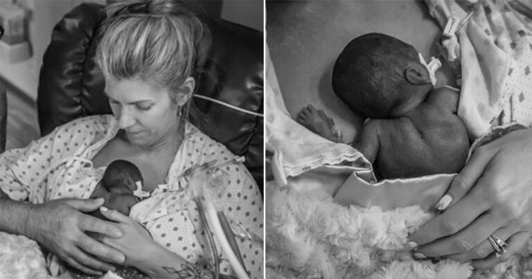 Ibu Angkat Mengucapkan Selamat Tinggal pada Bayi Prematur Mikro