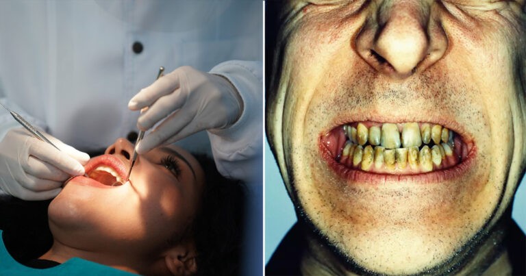 Dokter Gigi Menceritakan Kasus-kasus Paling Mengerikan yang Pernah Dia Lihat Saat Bekerja