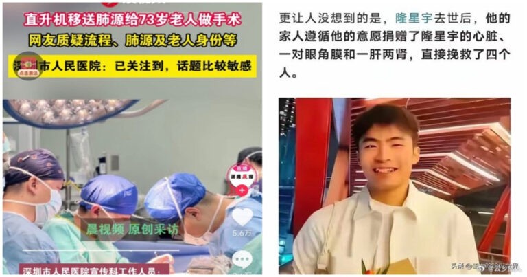 Pengiriman Paru-paru dalam 33 Menit oleh Rumah Sakit Shenzhen, Netizen Tiongkok Bertanya-tanya Siapa “Lao Yang” Hingga Asal Muasal Organ 