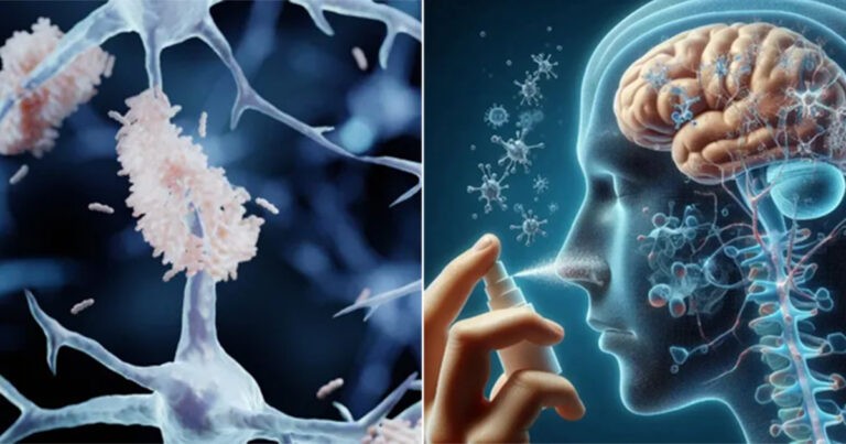 Semprotan Hidung Bisa ‘Mencuci’ Otak Hingga Bersih dari Protein Penyebab Alzheimer