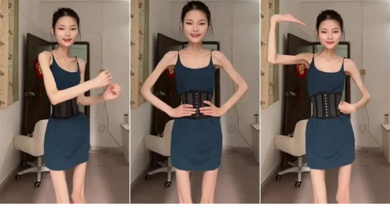 Wanita Dewasa yang Beratnya Hanya 25 Kilogram Masih Ingin Kurus Lagi