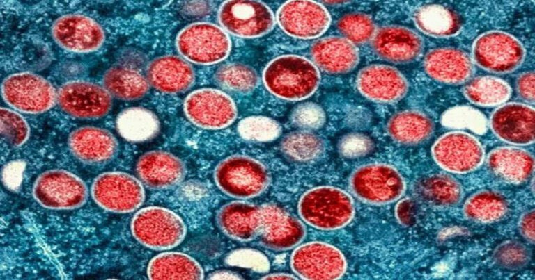 Afrika Umumkan Wabah Virus Mpox Sebagai Keadaan Darurat Kesehatan Masyarakat 