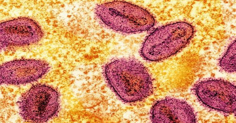 Filipina Deteksi Kasus Baru Virus Mpox, Si Pasien Tak Memiliki Riwayat Perjalanan ke Luar Negeri