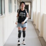 Wanita-Malaysia-Bahagia-dengan-Lengan-dan-Kaki-Palsu-1