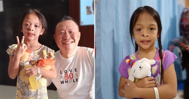 Dokter dari Taiwan Membantu Menjahit Celah Sebesar Bola Pingpong di Hidung Gadis Kecil dari Philipina