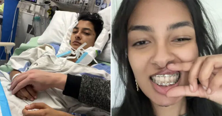 Wanita Patah Rahang Setelah Mencoba Menggigit Permen Jawbreaker