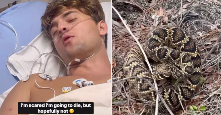 Momen Mengerikan Saat Seorang Influencer Menyiarkan Langsung Dirinya Digigit Ular Berbisa dan Berakhir di ICU