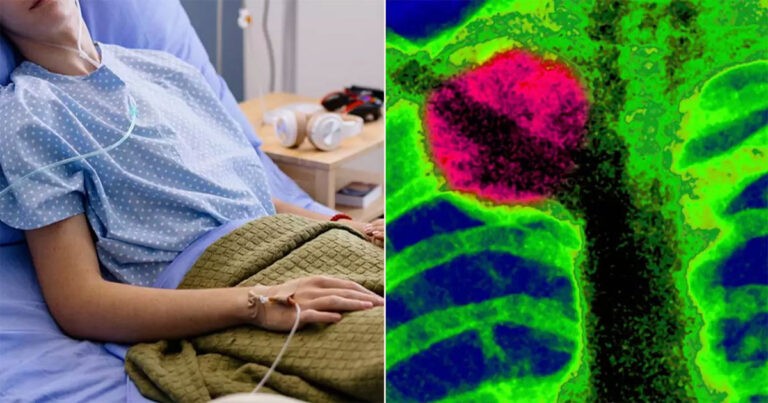 Seorang Remaja Laki-laki Diberi Tahu oleh Dokter Bahwa Dia Mengalami Cedera Otot, Ternyata Itu adalah Kanker Terminal yang Langka