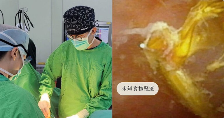 Pria di Taiwan Mengeluh Ada Darah dalam Urinenya, Dokter Menemukan Serpihan Makanan di Dalam Kandung Kemih