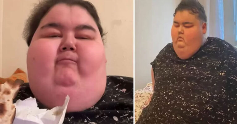 Streamer Mukbang Berusia 24 Tahun Meninggal Akibat Komplikasi Terkait Obesitas