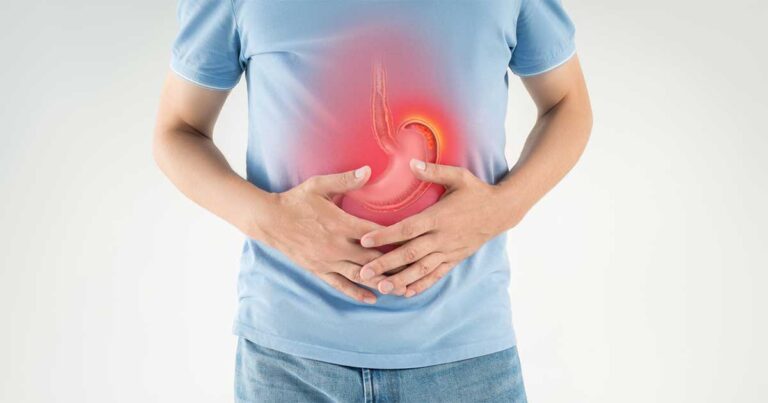 5 Tips Diet Ini Dapat Membantu Mencegah Refluk Asam Lambung di Musim Panas Ini