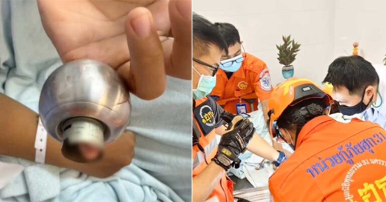 Jari Kelingking Gadis Remaja di Thailand Tersangkut di Gagang Pintu Selama 9 Jam, Dokter Menggunakan Perkakas Listrik untuk Membebaskannya
