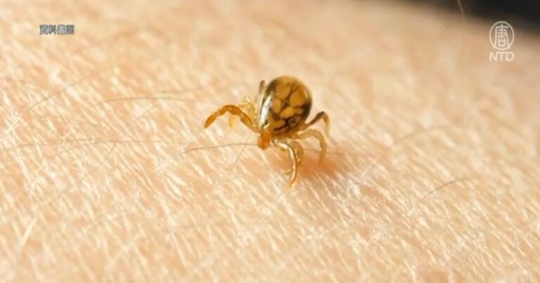 Jumlah Penderita Penyakit Lyme di Kanada Terus Meningkat, Sejumlah Selebriti Ternama Pernah Terinfeksi