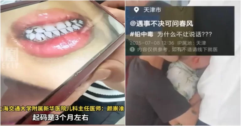 Kasus Keracunan Timbal Anak di Tianshui, Gansu, Tiongkok, Rumah Sakit di Xi’an dan Shanghai Ditekan oleh Otoritas